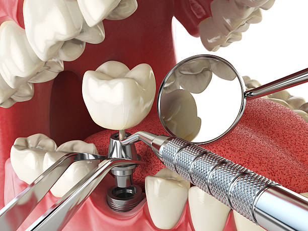 Best Walk-In Emergency Dentist in Lake Bluff, IL